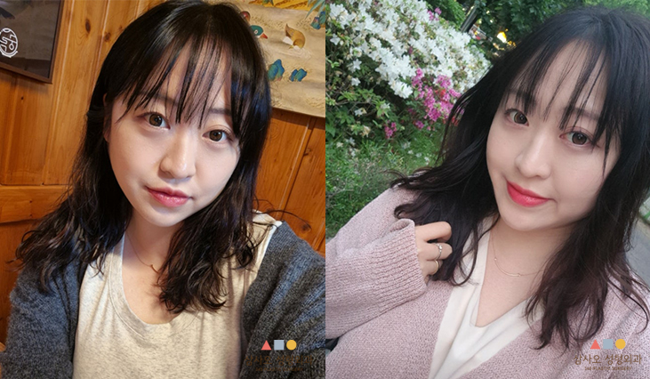 수술 후