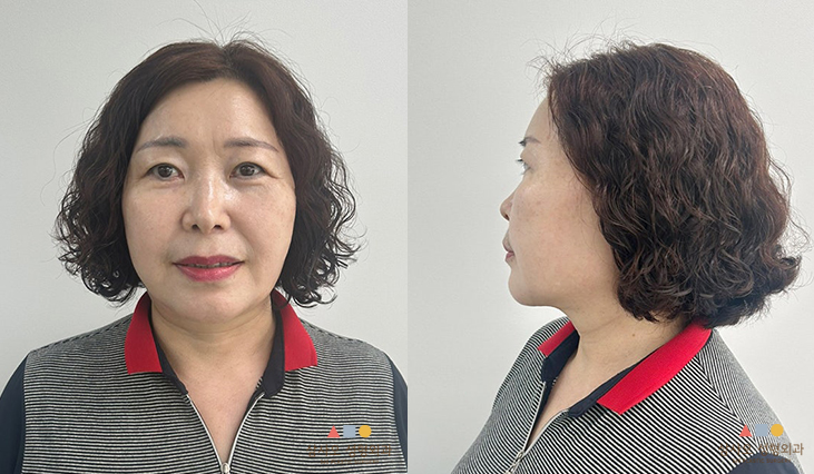 수술 후