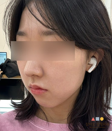 수술 후
